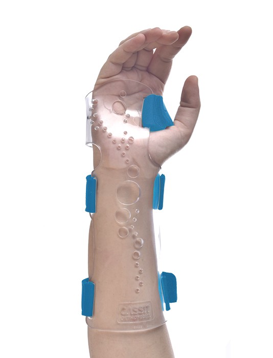 Ulnar Functional Splint